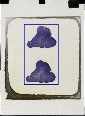 Media type: image; Special Collections 3043   shows specimen_part histological serial section;